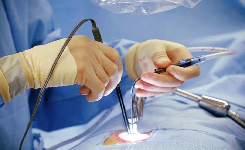 Endoscopic spine surgery